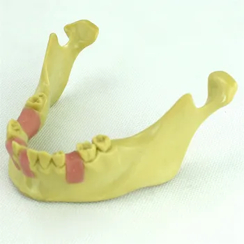Dental Implant Teeth Practice Model Anatomical Lower Jaw Mandibular Model For Medical Dentist Demonstration Teaching Training
Dental Implant Teeth Practice Model Anatomical Lower Jaw Mandibular Model For Medical Dentist Demonstration Teaching Training