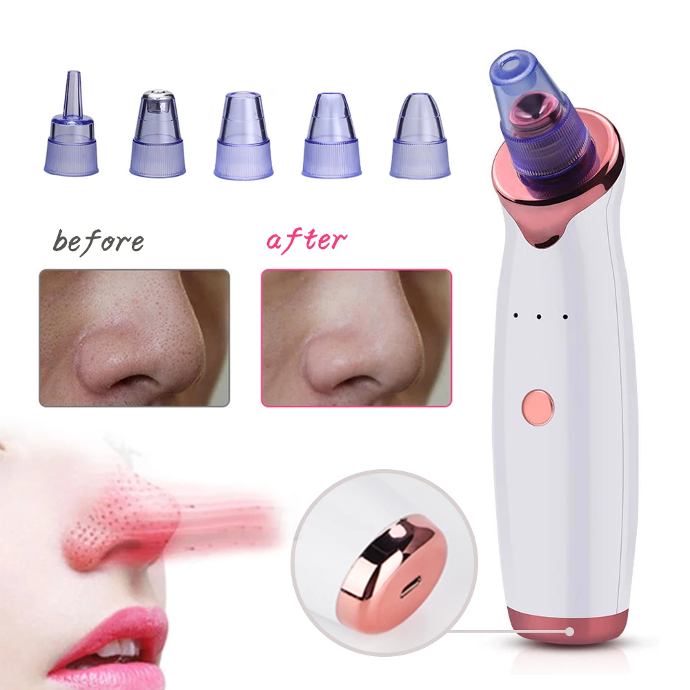 Multi-Function Beauty Device Nose Deep T Zone Blackhead Remover Vacuum Acne Remover Artifact Facial Skin Care Cleans Pores SPA
Multi-Function Beauty Device Nose Deep T Zone Blackhead Remover Vacuum Acne Remover Artifact Facial Skin Care Cleans Pores SPA
