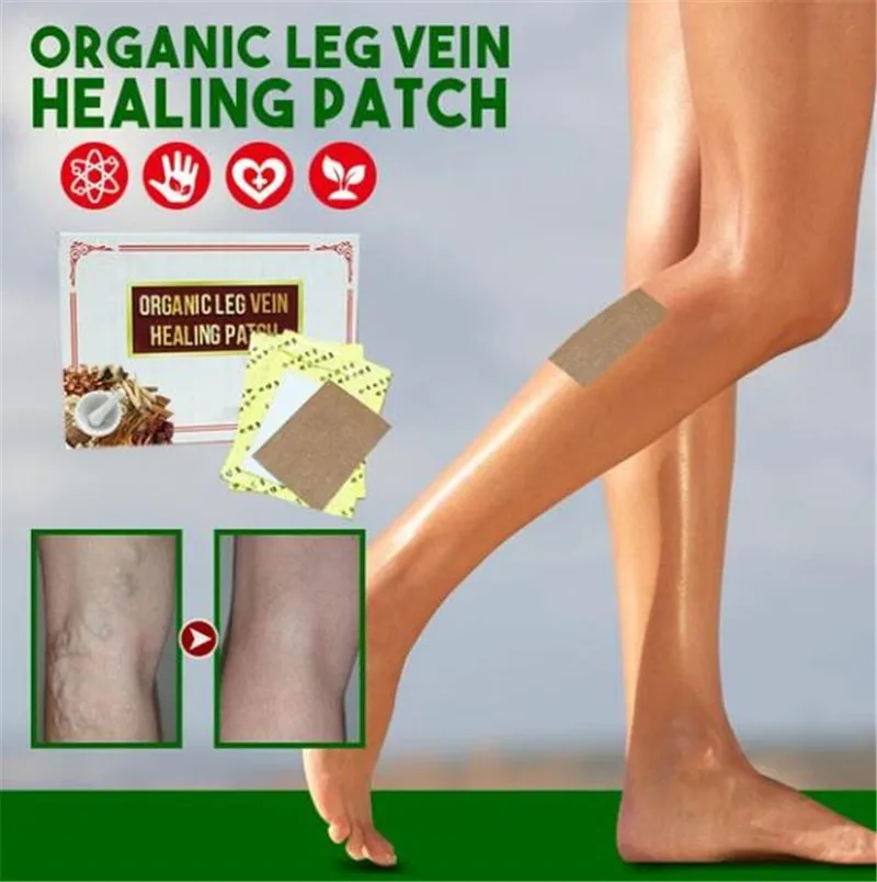 6 пластырей для лечения вен ног органический пластырь варикозного расширения |