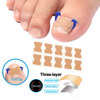 Ingrown Toenail Corrector Stickers Foot Care Stickers Non Glue Toenail Patch Adhesive Toenail Correction Pedicure Toe Treatment
Ingrown Toenail Corrector Stickers Foot Care Stickers Non Glue Toenail Patch Adhesive Toenail Correction Pedicure Toe Treatment