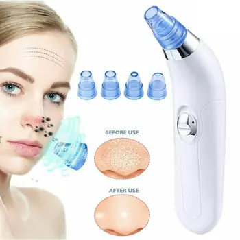 Facial Cleaner Nose Blackhead Remover Deep Pore Acne Pimple Removal Vacuum Suction Diamond T Zone Beauty Tool Face Household SPA
Facial Cleaner Nose Blackhead Remover Deep Pore Acne Pimple Removal Vacuum Suction Diamond T Zone Beauty Tool Face Household SPA