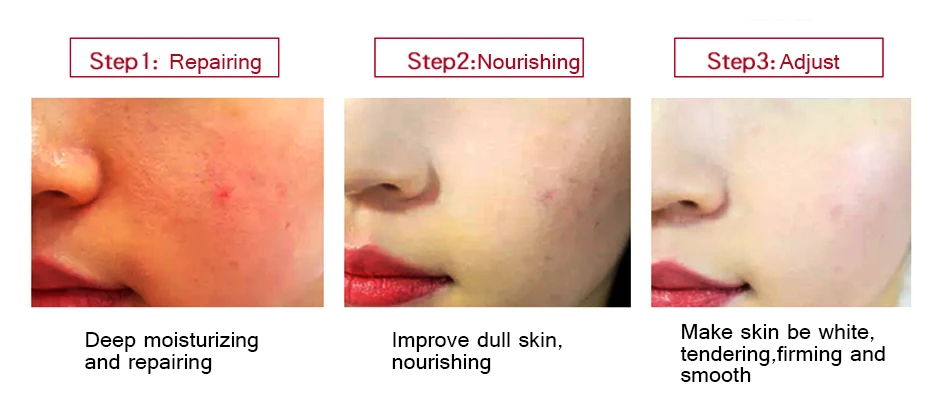 OMY LADY Hyaluronic Acid Moisturizing Face Cream Anti-Wrinkle Anti-Aging Whitening Lifting Firm Brighten Day Cream Skin Care OMY LADY Hyaluronic Acid Moisturizing Face Cream Anti-Wrinkle Anti-Aging Whitening Lifting Firm Brighten Day Cream Skin Care