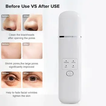 Kemei 1.5W High Frequency LED Screen Skin Scrubber Ultrasonic Spatula Facial Lifting Cleansing Moisturizing Blackhead
Kemei 1.5W High Frequency LED Screen Skin Scrubber Ultrasonic Spatula Facial Lifting Cleansing Moisturizing Blackhead
