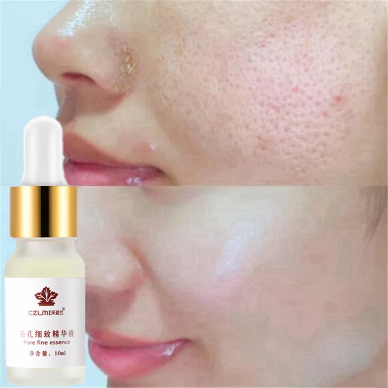 Hot Face Primer Makeup Pores Shrinking Moisturizer Essence Serum Oil Control Matte Base Primer Make Up Pore Minimizer 10ML
Hot Face Primer Makeup Pores Shrinking Moisturizer Essence Serum Oil Control Matte Base Primer Make Up Pore Minimizer 10ML
