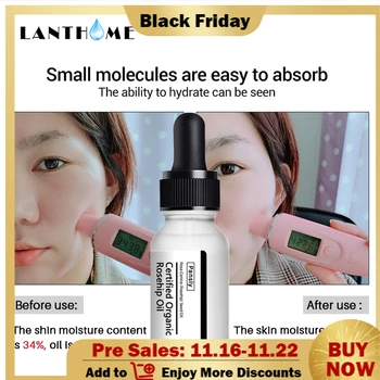 10ml Original Pure Rosehip Essential Oil Anti-Aging Spots Stretch Marks Remover Relieve Stress Organic Skin Care Ageing skin
10ml Original Pure Rosehip Essential Oil Anti-Aging Spots Stretch Marks Remover Relieve Stress Organic Skin Care Ageing skin