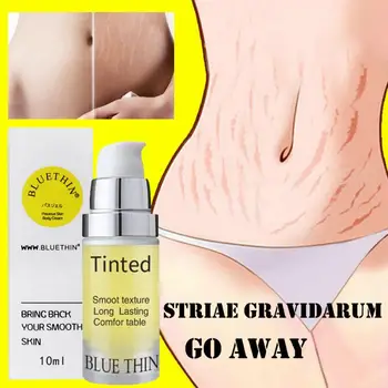 Stretch Marks Obesity Pattern Growth Pattern Repair Cream Removal Scar Marks Cream Treatment Nourish The Skin TSLM1
Stretch Marks Obesity Pattern Growth Pattern Repair Cream Removal Scar Marks Cream Treatment Nourish The Skin TSLM1
