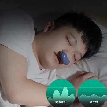 

Electric Anti Snoring Prevention Electronic Device Sleep Stop Snore Aid Stopper