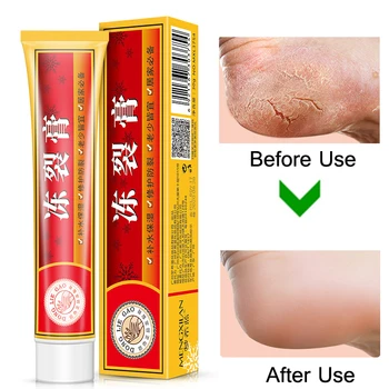 Powerful Hand Foot Crack Cream Heel Chapped Peeling Foot and Hand Repair Anti Chapping Wrinkle Treatment Skin Cracking
Powerful Hand Foot Crack Cream Heel Chapped Peeling Foot and Hand Repair Anti Chapping Wrinkle Treatment Skin Cracking