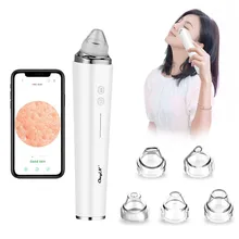 Wifi Camera Connection Blackhead Remover Vacuum Negative Pressure Acne Comedone Extractor USB Rechargeable Dead Skin Pore Clean
Wifi Camera Connection Blackhead Remover Vacuum Negative Pressure Acne Comedone Extractor USB Rechargeable Dead Skin Pore Clean