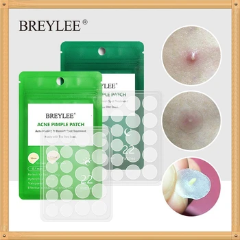 BREYLEE Acne Pimple Patch Acne Treatment Stickers Pimple Remover Tool Blemish Spot Skin Care Facial Mask Waterproof 22 Patches 
BREYLEE Acne Pimple Patch Acne Treatment Stickers Pimple Remover Tool Blemish Spot Skin Care Facial Mask Waterproof 22 Patches
