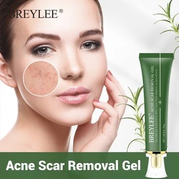 BREYLEE Acne Scar Removal Gel Tea Tree Acne Treatment Scar Remove Nicotinamide Salicylic Acid Skin Repair Oil Control Skin Care
BREYLEE Acne Scar Removal Gel Tea Tree Acne Treatment Scar Remove Nicotinamide Salicylic Acid Skin Repair Oil Control Skin Care