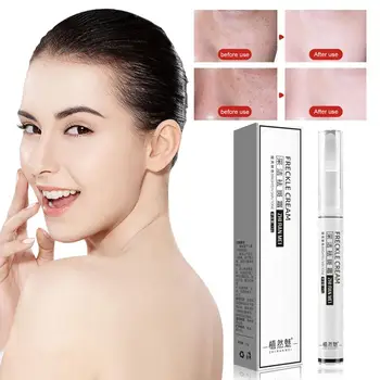 Blemish Removal Gel Freckle Cream Brighten Complexion Makeup Care Tools Easy To Wear Silky Cream Blemish Removal TSLM2
Blemish Removal Gel Freckle Cream Brighten Complexion Makeup Care Tools Easy To Wear Silky Cream Blemish Removal TSLM2
