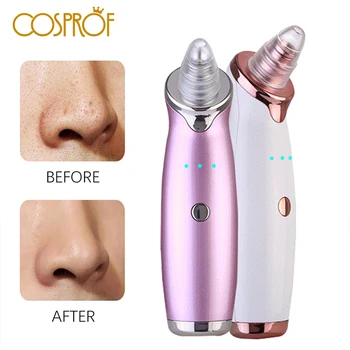 Pore Cleaner Blackhead Remover Vacuum Electric Nose Face Deep Cleansing Skin Care Machine Birthday Gift Dropshipping Beauty Tool
Pore Cleaner Blackhead Remover Vacuum Electric Nose Face Deep Cleansing Skin Care Machine Birthday Gift Dropshipping Beauty Tool