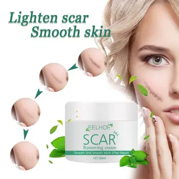 Scar Cream Scar Removing Cream Acne Scar Stretch Mark Remover Repair Cream Whitening Cream Skin Care TSLM1
Scar Cream Scar Removing Cream Acne Scar Stretch Mark Remover Repair Cream Whitening Cream Skin Care TSLM1