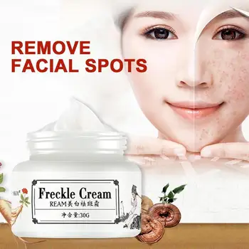 Freckle Cream Acne Scar Treatment Face Cream Freckle Remover Care Face Antiaging Whitening Scar Spot Acne Acne Pimple From 30G 
Freckle Cream Acne Scar Treatment Face Cream Freckle Remover Care Face Antiaging Whitening Scar Spot Acne Acne Pimple From 30G