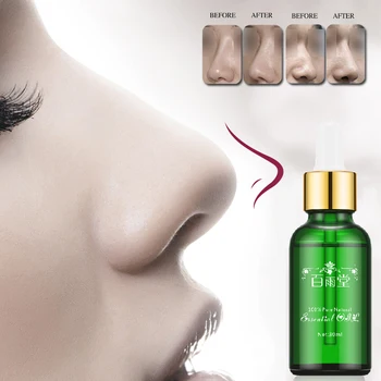 Nose Up Heighten Rhinoplasty Essential Oil 30ml Nasal Bone Rmodeling Pure Natural Nose Care Thin Smaller Nose 100% Effective
Nose Up Heighten Rhinoplasty Essential Oil 30ml Nasal Bone Rmodeling Pure Natural Nose Care Thin Smaller Nose 100% Effective