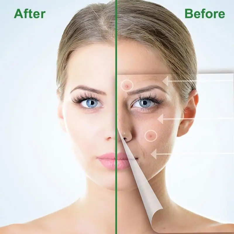 24 Patchs Invisible Acne Pimple Patch Acne Treatment Stickers Pimple Remover Tool Blemish Treatment Facial Mask Skin Care TSLM1