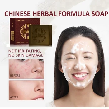 Removal Blackhead Soap Anti Mites Oil Control Wash Face Soap Tibetan Cleansing Soap Face Washing Product
Removal Blackhead Soap Anti Mites Oil Control Wash Face Soap Tibetan Cleansing Soap Face Washing Product
