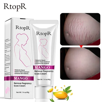RtopR Mango Remove Pregnancy Scars Acne Cream Stretch Marks Treatment Maternity Repair Anti-Aging Skin Firming Body Creams
RtopR Mango Remove Pregnancy Scars Acne Cream Stretch Marks Treatment Maternity Repair Anti-Aging Skin Firming Body Creams