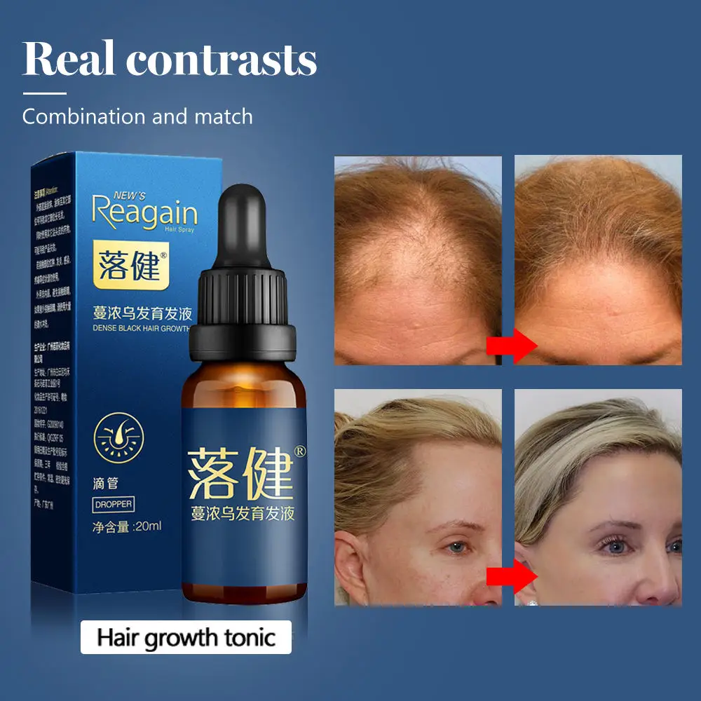 Эссенция для роста волос масло средство ухода за волосами натуральная сыворотка