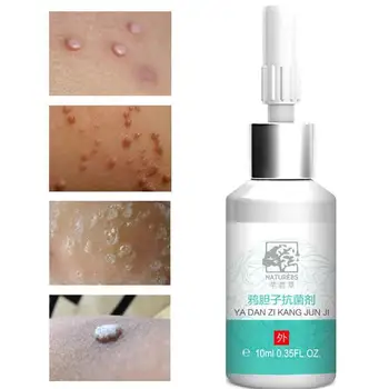 10ml Antibacterial Solution 0f Body Hand Feet Corn Cocoons Warts Thorn Removal Liquid Foot Skin Calluses Anti Itching Musk Cream 
10ml Antibacterial Solution 0f Body Hand Feet Corn Cocoons Warts Thorn Removal Liquid Foot Skin Calluses Anti Itching Musk Cream