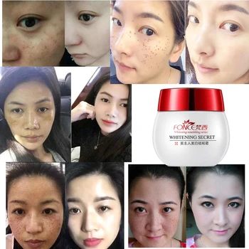 Korea Strong effect Whitening Cream Face Remove Freckles Reduces Age Spots Fade Dark Spot treatment Stain Facial Serum 30g
Korea Strong effect Whitening Cream Face Remove Freckles Reduces Age Spots Fade Dark Spot treatment Stain Facial Serum 30g