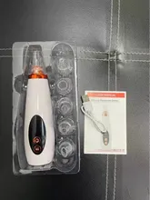 Removedor profundo espinilla profesional, limpieza de poros, vacío, belleza Facial, cuidado de la piel, herramientas