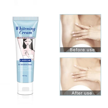 New Body Creams Armpit Whitening Cream Between Legs Knees Private Parts Whitening Formula Armpit Whitener Intimate Skin Care
New Body Creams Armpit Whitening Cream Between Legs Knees Private Parts Whitening Formula Armpit Whitener Intimate Skin Care