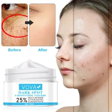 Dark Spot Removal Cream for Face Age Spots Freckles Chloasma Remover Cream Skin Whitening Cream Suitable for All Skin Types
Dark Spot Removal Cream for Face Age Spots Freckles Chloasma Remover Cream Skin Whitening Cream Suitable for All Skin Types