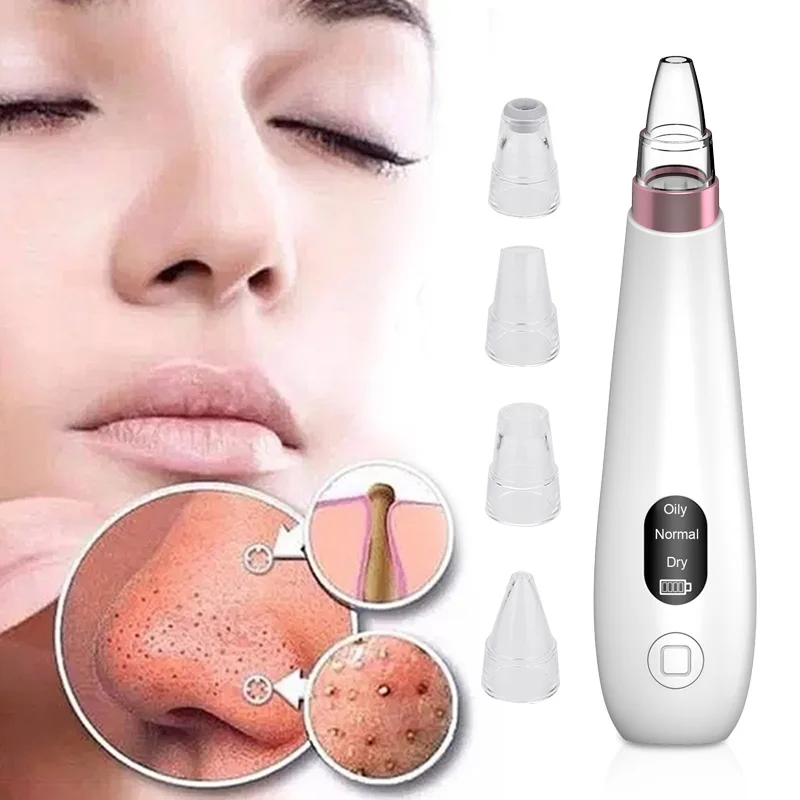 Acne Removing Apparatus Black Head Removal Face Cleaner Effective Fashion Magic 4 Treatment Heads Deep Clean Massager Vibration
Acne Removing Apparatus Black Head Removal Face Cleaner Effective Fashion Magic 4 Treatment Heads Deep Clean Massager Vibration