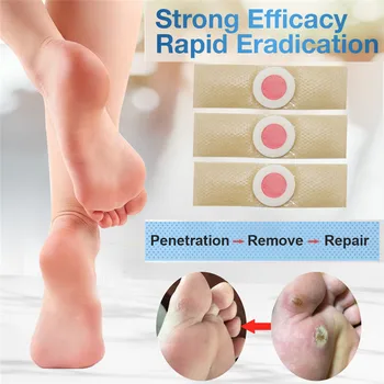 1Box Feet Corns/ Warts Removal Patch Pain Relief Remover Foot Callus Medical Plaster Soften Skin Cutin Feet Care Tool Foot Patch
1Box Feet Corns/ Warts Removal Patch Pain Relief Remover Foot Callus Medical Plaster Soften Skin Cutin Feet Care Tool Foot Patch