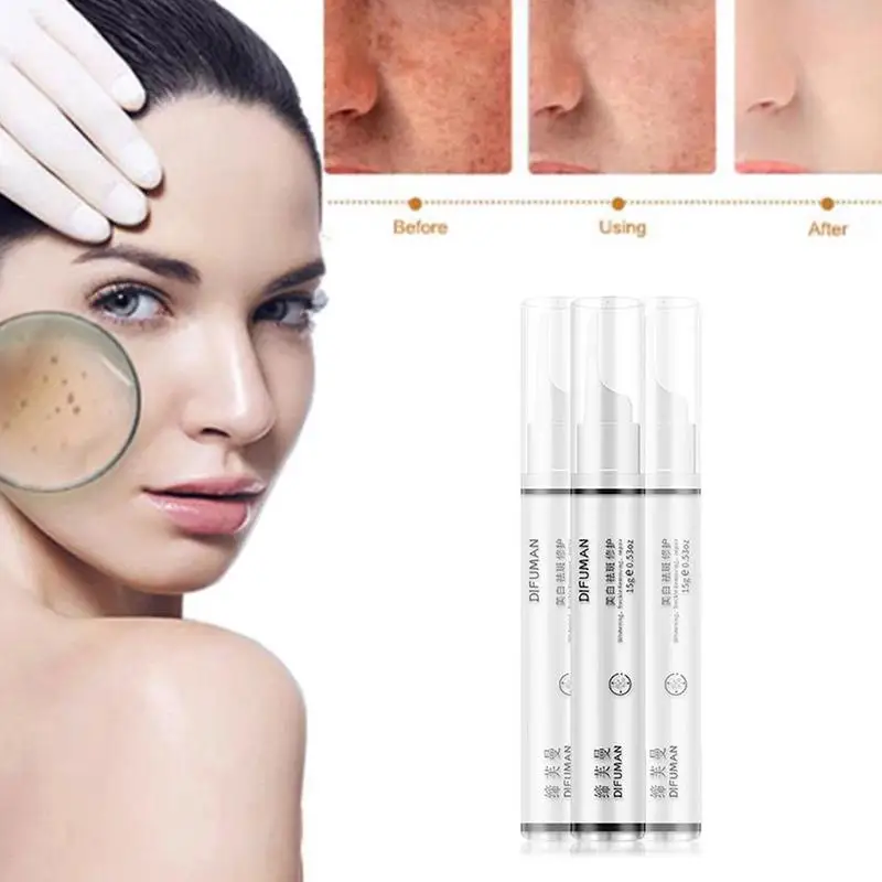 New Herbs Instant Blemish Removal Gel Whitening Anti Freckle Cream Pen Effectively Remove the Freckle Pigmented Melanin Spots
New Herbs Instant Blemish Removal Gel Whitening Anti Freckle Cream Pen Effectively Remove the Freckle Pigmented Melanin Spots