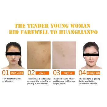 30ml Vitamin C Serum Whitening Serum Skin Care Whitening Acid Freckle Face Spots Hyaluronic Cream Remover N3S9
30ml Vitamin C Serum Whitening Serum Skin Care Whitening Acid Freckle Face Spots Hyaluronic Cream Remover N3S9