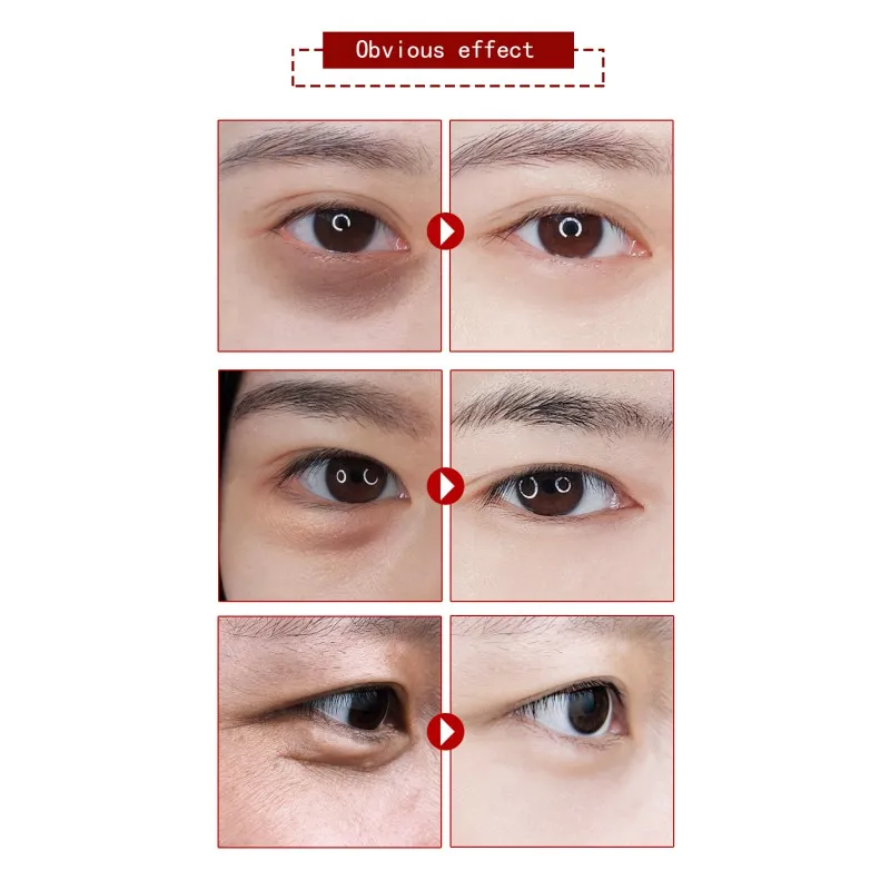 QX0585A (14)