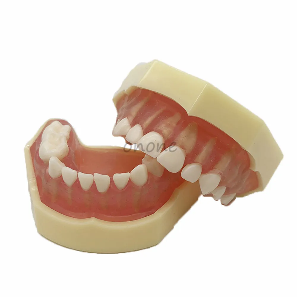 Dental Typodont Soft Gum mini Study Teeth Model with Removable Teeth Model Dental Study Teach Teeth Model
Dental Typodont Soft Gum mini Study Teeth Model with Removable Teeth Model Dental Study Teach Teeth Model