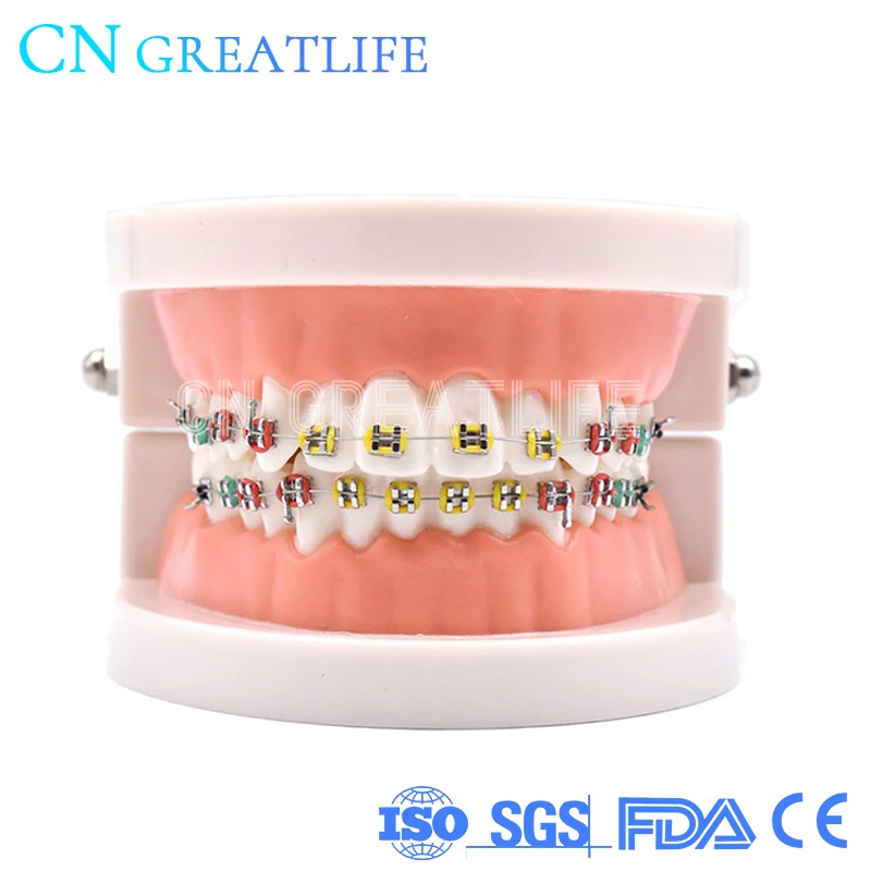 Dental Orthodontic Demonstration Treatment Model Teeth Model with Metal Bracket Arch Wire Explaining Model with Braces
Dental Orthodontic Demonstration Treatment Model Teeth Model with Metal Bracket Arch Wire Explaining Model with Braces