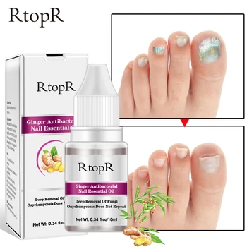 Ginger Extract Nail Treatment Liquid Remove Onychomycosis Fungi Nail Repair Essence Nourishing Professional Nail Care Oil TSLM1 
Ginger Extract Nail Treatment Liquid Remove Onychomycosis Fungi Nail Repair Essence Nourishing Professional Nail Care Oil TSLM1