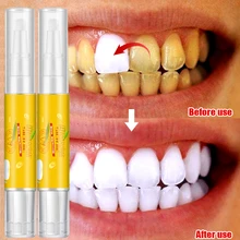 3ml Popular White Teeth Whitening Pen Tooth Gel Bleach Remove Stains oral hygiene Peroxide Gel Tooth Kit Dental White
3ml Popular White Teeth Whitening Pen Tooth Gel Bleach Remove Stains oral hygiene Peroxide Gel Tooth Kit Dental White