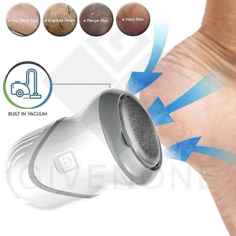 Portable Electric Foot File USB Charging Pedicure Machine Foot Repair Machine Dead Skin Calluses Remover Home Foot Care Tool
Portable Electric Foot File USB Charging Pedicure Machine Foot Repair Machine Dead Skin Calluses Remover Home Foot Care Tool