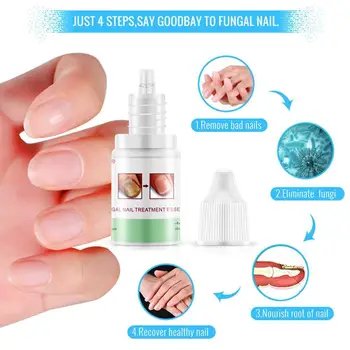10ml OMY LADY Fungal Nail Treatment Essence Foot Nail Infection Serum Onychomycosis Paronychia Repair Fungus Anti M0G5
10ml OMY LADY Fungal Nail Treatment Essence Foot Nail Infection Serum Onychomycosis Paronychia Repair Fungus Anti M0G5