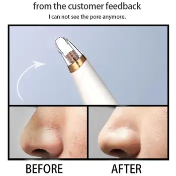 1PC Blackhead Remover Face Deep Cleaner Pore Acne Pimple Removal Vacuum Suction Facial Beauty Clean Skin Care SPA Tool
1PC Blackhead Remover Face Deep Cleaner Pore Acne Pimple Removal Vacuum Suction Facial Beauty Clean Skin Care SPA Tool