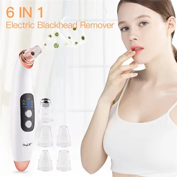 Electric Blackhead Remover Pore Vacuum Suction Diamond Dermabrasion Face Cleaner Acne Removal Extractor Facial Skin Care Tool 46
Electric Blackhead Remover Pore Vacuum Suction Diamond Dermabrasion Face Cleaner Acne Removal Extractor Facial Skin Care Tool 46