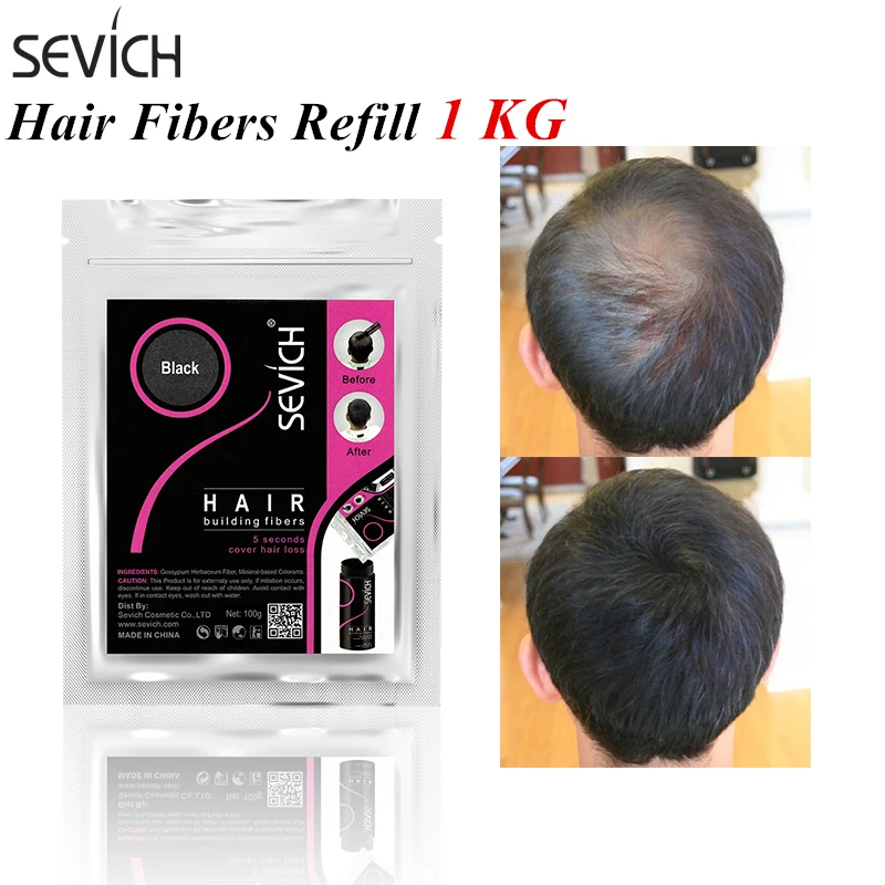 Sevich 1 kg Hair Building Fiber Hair Loss Product Keratin Fiber Refill Thickening Fibers Hair Powders Instant Concealer 10 Color
Sevich 1 kg Hair Building Fiber Hair Loss Product Keratin Fiber Refill Thickening Fibers Hair Powders Instant Concealer 10 Color