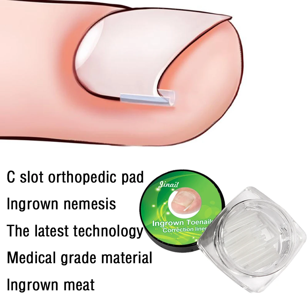 10pcs/set Ingrown Nail Pads Orthopedic Nail Filling Groove Pad Ingrown Nail Brace Correction Treatments Ingrown Foot Care Tools
10pcs/set Ingrown Nail Pads Orthopedic Nail Filling Groove Pad Ingrown Nail Brace Correction Treatments Ingrown Foot Care Tools