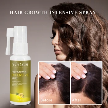Fast Powerful Hair Growth Essential Oil Spray Hot Sale Original Authentic Prevent Dry Hair Repair Hair Loss Products 
Fast Powerful Hair Growth Essential Oil Spray Hot Sale Original Authentic Prevent Dry Hair Repair Hair Loss Products