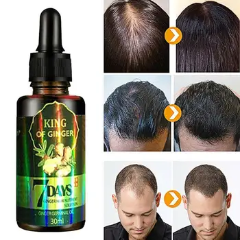 30ml Ginger Hair Growth Nutrient Solution Hair Loss Oil Hair Women Protection Treatment For Men Essential X6X5
30ml Ginger Hair Growth Nutrient Solution Hair Loss Oil Hair Women Protection Treatment For Men Essential X6X5