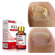 10ml Nail Fungal Treatment Essence Anti-Infection Fungus Removal Solution for Paronychia Onychomycosis for Nail Feet Care
10ml Nail Fungal Treatment Essence Anti-Infection Fungus Removal Solution for Paronychia Onychomycosis for Nail Feet Care