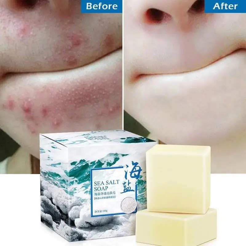 Sea Salt Soap Cleaner Removal Pimple Pores Acne Treatment Goat Milk Moisturizing Face Care Wash Basis For Soap Savon Au Hot 100g
Sea Salt Soap Cleaner Removal Pimple Pores Acne Treatment Goat Milk Moisturizing Face Care Wash Basis For Soap Savon Au Hot 100g