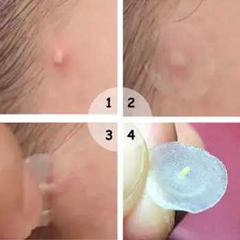 108sheets Transparent Hydrocolloid Waterproof Concealer Concealer Patch Pad Stick Absorbent Invisible Acne Transparent Acne D4A1 
108sheets Transparent Hydrocolloid Waterproof Concealer Concealer Patch Pad Stick Absorbent Invisible Acne Transparent Acne D4A1