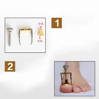 1pc Ingrown Toe Nail Recover Toenail Correction Pedicure Fixer Straightener Toe Paronychia Nail Brace Pedicure Care Tool
1pc Ingrown Toe Nail Recover Toenail Correction Pedicure Fixer Straightener Toe Paronychia Nail Brace Pedicure Care Tool